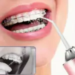 Oral-hygiene-water-flosser.webp